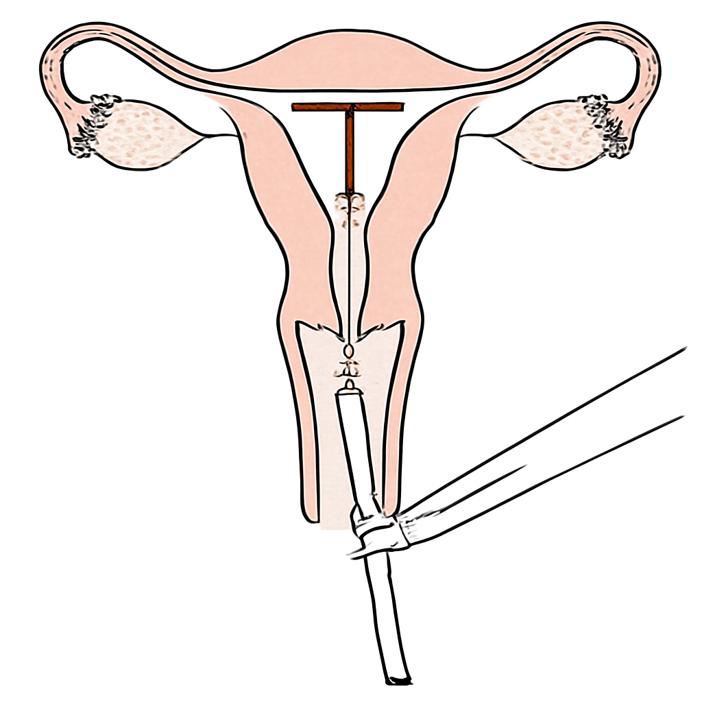 Question diagram