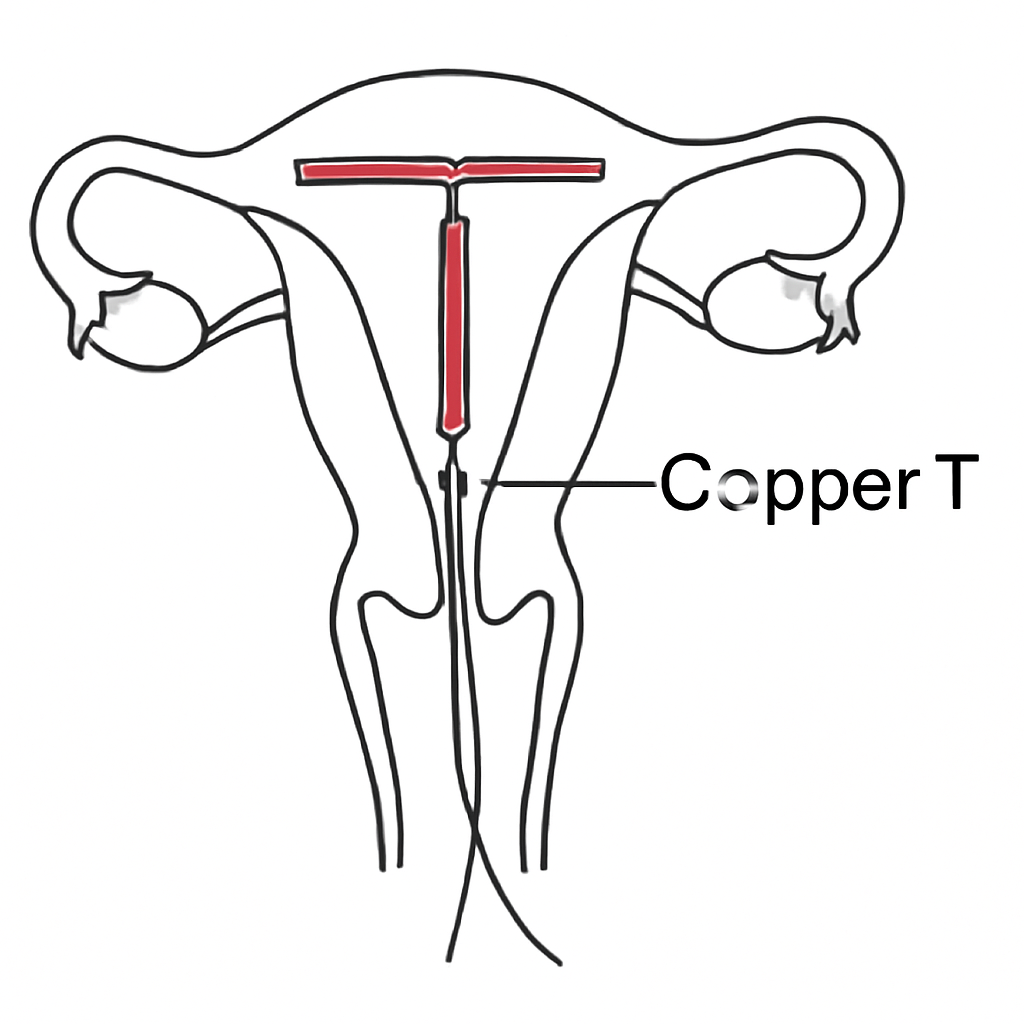 Question diagram