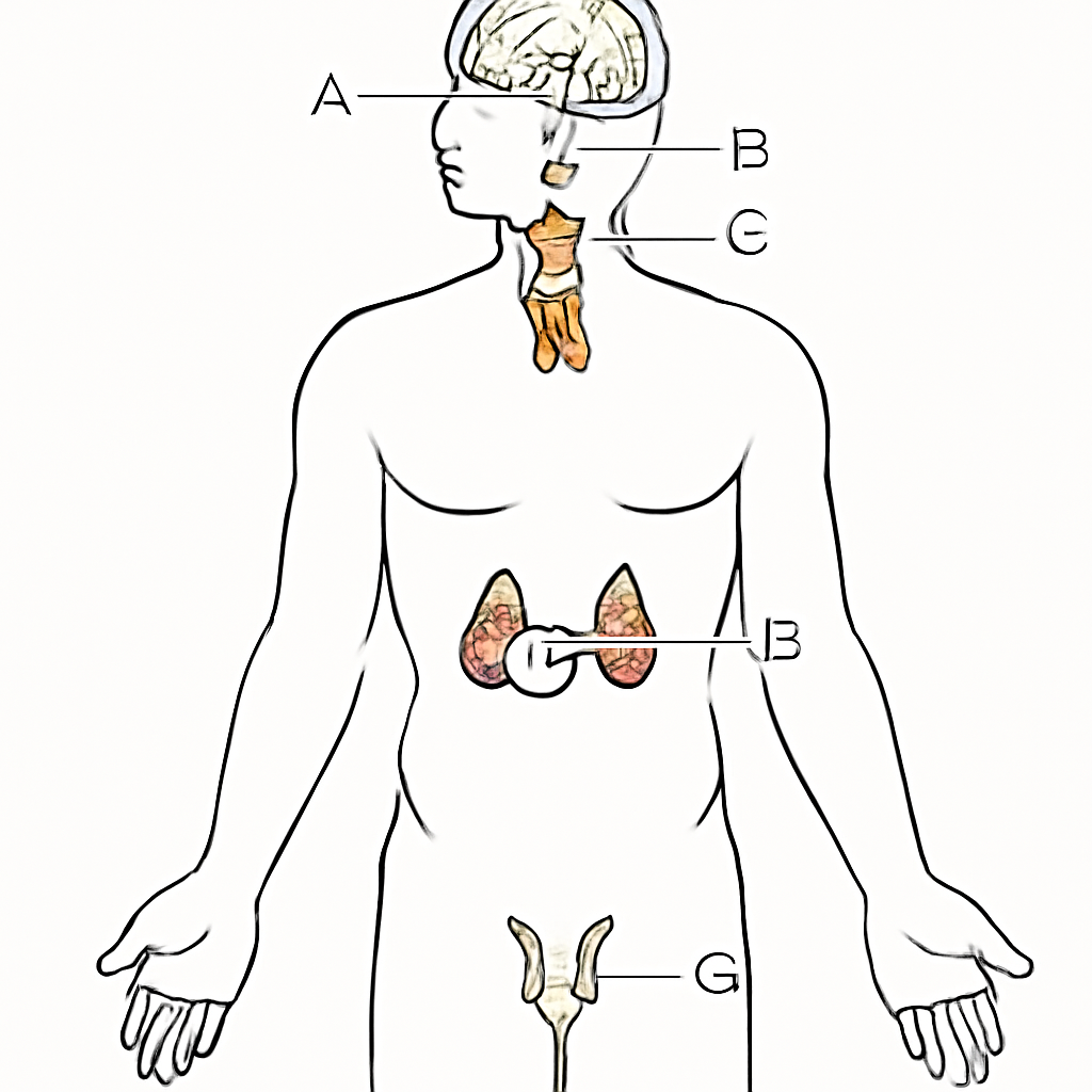 Question diagram
