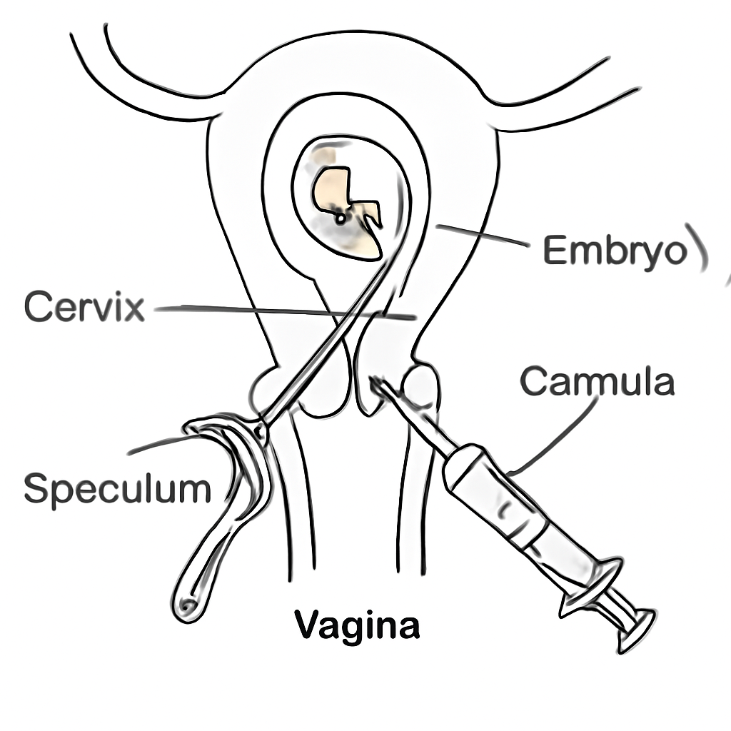 Question diagram